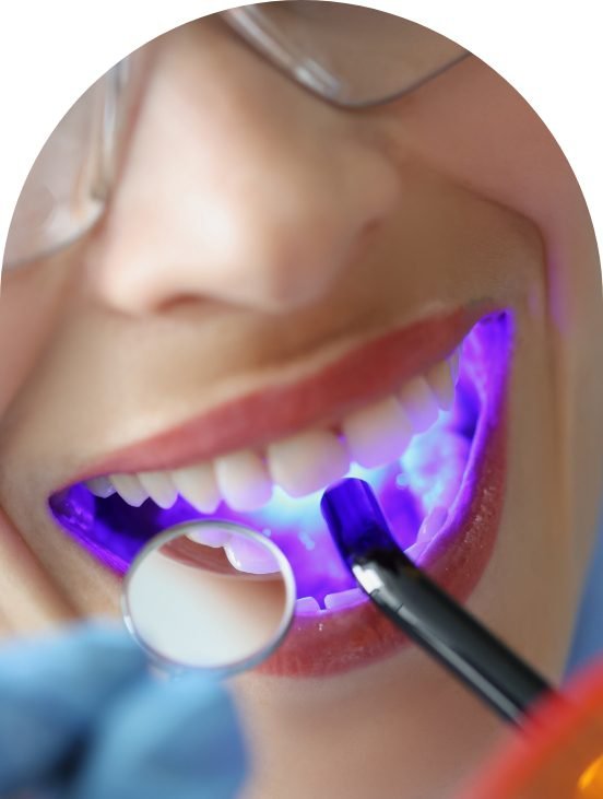 Fillings And Restorations