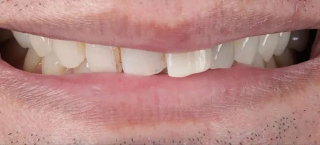 3 Before dental care