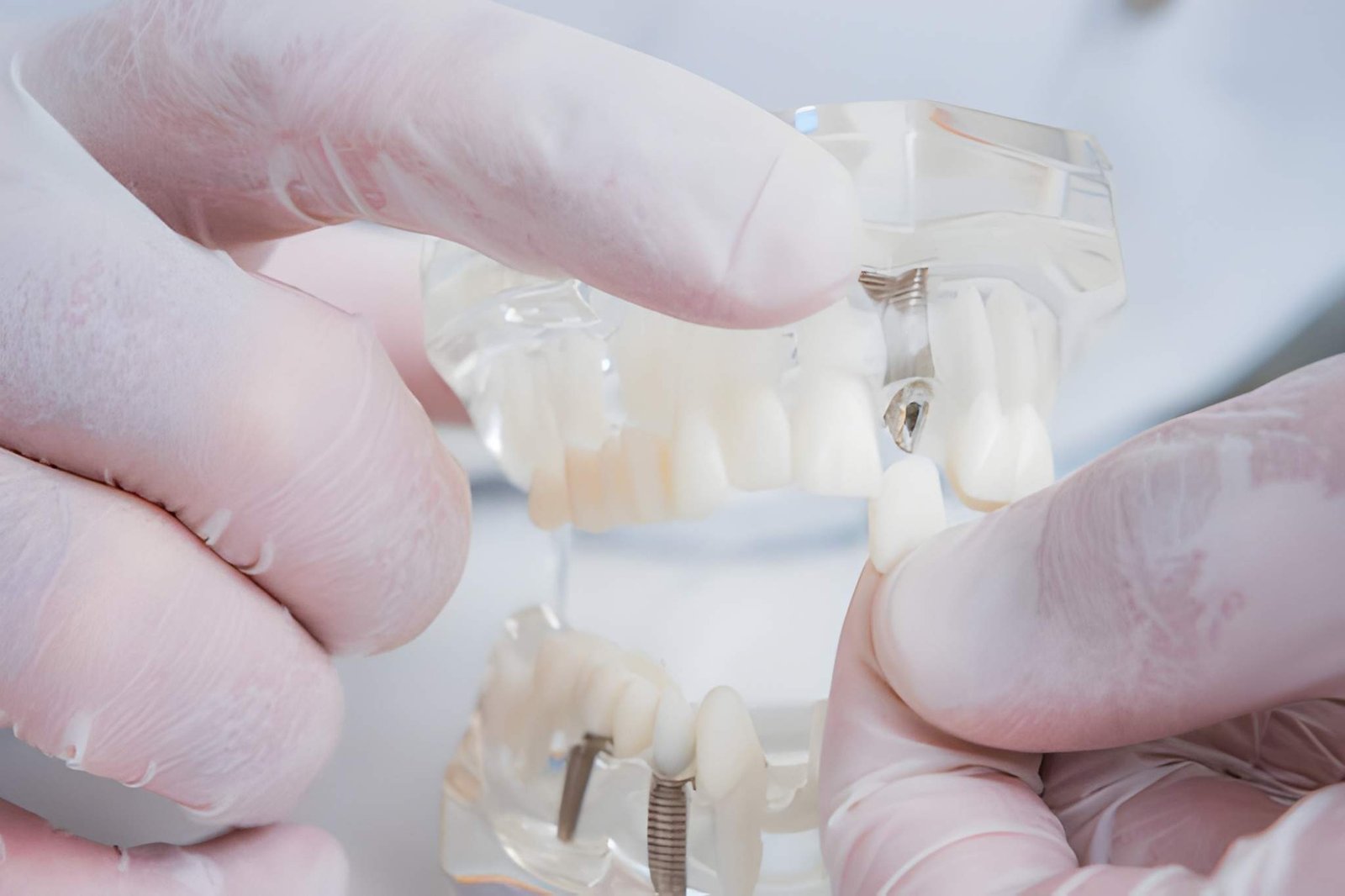 Dental Procedure