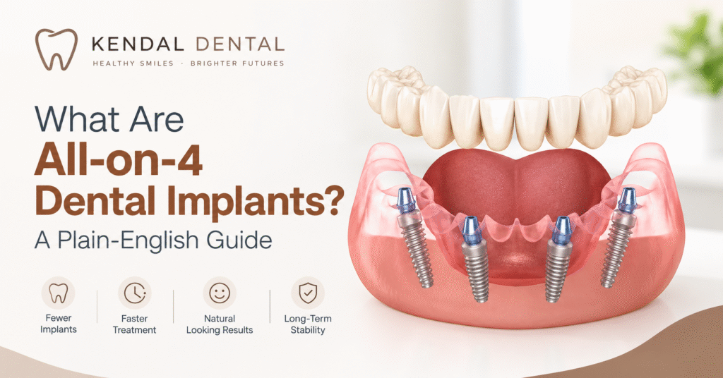 All-on-4 Dental Implants